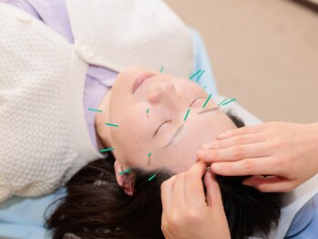 藤田はりきゅう治療院の写真/【ズーンと重い目の疲れに◎】目の周りを中心にしっかり施術!目の疲れ・重だるさなどに徹底アプローチ◇