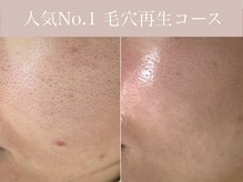 アリスビューティー(AliceBeauty)