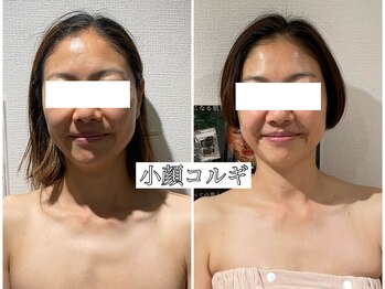 イデアルミー 大宮店(イデアルMe)/40代のお客様《小顔コルギ》