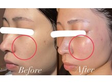 ヴィーナス 三ツ境店(VENUS)/オーガニック100%フェイシャル