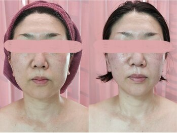 美容整体カラダリメイク(karada)/小顔矯正も人気です！