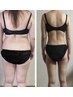【リピート◇No1】スッキリ感持続◎ダイエット&頭痛&コリ&浮腫み！アプローチ
