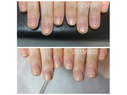 アンドネイル 海老名(&nail)の写真