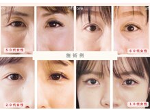 サロンドメイド バイ ラッシュディーバ 海老名店(Salon de MADE by LASH DIVA)/施術例