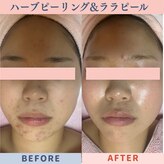 ポムポムボナー