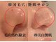 ポプリ(potpourri)の写真
