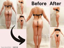 ミネルバエンダモロジー/エンダモロジー/痩身/ウェルネス