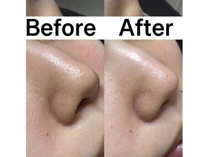 プルティティア 池下 今池 覚王山(Pultitia)の写真