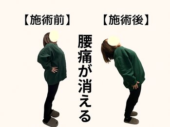 パルマ なかもず(Palma)/長引くしつこい腰痛卒業