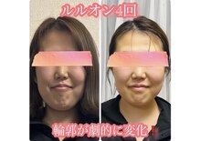 ヨサパーク ノワール(YOSA PARK Noir)