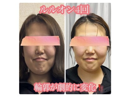 ヨサパーク ノワール(YOSA PARK Noir)の写真