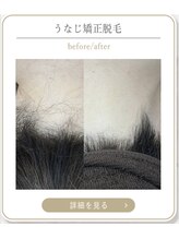 ミース 上野店/脱毛体験レポート♪