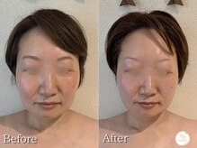 プリュボーテ(Pul Beaute)/口周りのダルさや重さを解消