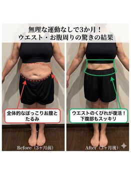 くによし整体院の写真/都城のダイエット専門!30代~60代がウエストー20cm、ー15kg減成功◎夏までに理想の姿へ♪