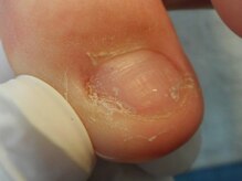 東京巻き爪研究所 みなみ風/