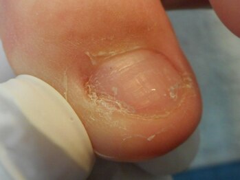 東京巻き爪研究所 みなみ風/