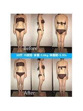 シェイプ 浜松本店/憧れ小顔に変身