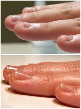 ケアリ(CAREri)/本来の美しい形へ！