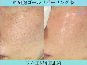 リメイククリニカルビューティー(Remake clinical beauty)/