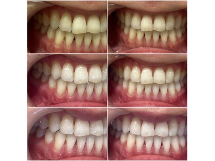 ホワイトニングショップ 霧島店の写真