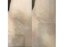 ナンバーサーティーン(NUM13ER)の雰囲気(脱毛も人気◎近場で時短で、自分のペースで通える!)