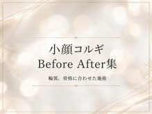 ビジョーラ 銀座本店(BEJORA)/当サロンコルギBefore After集