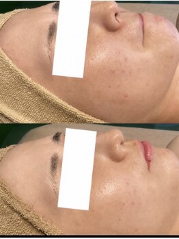 ミラリア(mirallia)の写真/素肌に自信を。肌本来の美しさを引き出すハーブケア