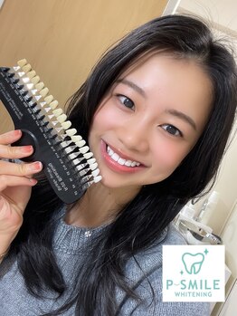 ホワイトベース(White Base)/お客様の施術後！！