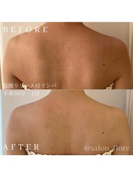 フローレ 平針店(Flore)/デスクワークによる肩こりに