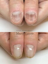 マリーロール 淀屋橋本店(Marie Laure)/自爪育成/深爪矯正/ネイルケア