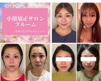 小顔矯正サロン ブルーム