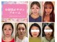 小顔矯正サロン ブルームの写真