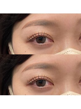 リン 表参道(RiN.)/ぱっちりラッシュリフト