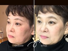 レディゴー(LADY GO)/華のある大人メイク