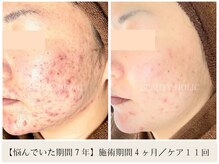 ビューティーホリック 蘇我店(BEAUTY HOLIC)の雰囲気（「あなたに合ったケア」が、あなたにとって最短の道です）