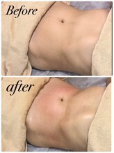 ソルツーサロン マナ(MANA)/Wマシンで脂肪燃焼＆代謝UP