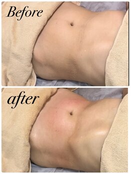 ソルツーサロン マナ(MANA)/Wマシンで脂肪燃焼＆代謝UP