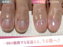 常に視界に入る手元をより綺麗に、印象が変わります♪