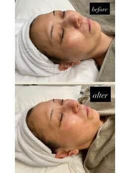 レビア(REVIA)/毛穴、顔全体のくすみを改善◎