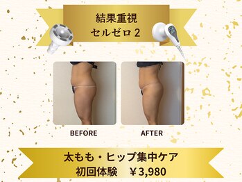 メリッサ(Melissa)の写真/結果重視の方必見！下半身太り・むくみ悩みさんへ｜スッキリ美脚体験