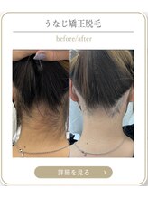 ミース 上野店/スッキリうなじに感動