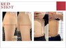 二の腕お腹にも結果早い矯正付き【レッドショット脂肪分解6cc】90分￥36000
