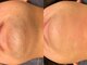 オンセ(once)の写真