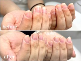 自爪育成　爪のコンプレックス