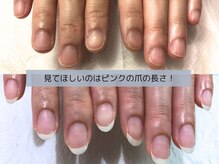 アリエ(allie)/深爪矯正から更に美しく美爪強化