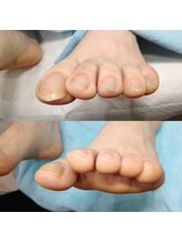 ドクターネイル爪革命 長野店/【美爪ケア】ネイル/フット