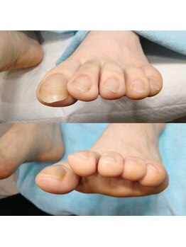 【美爪ケア】ネイル/フット