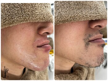 サロンエム 西荻窪(salon M)/ひげワックス