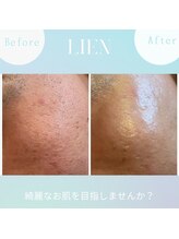 リアン(LIEN)/キメが整ってお肌の潤いUP