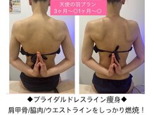 リンダ(Rinda)の雰囲気（つらい肩こりが楽に♪背面痩せでお顔のたるみ防止に繋がります!!）